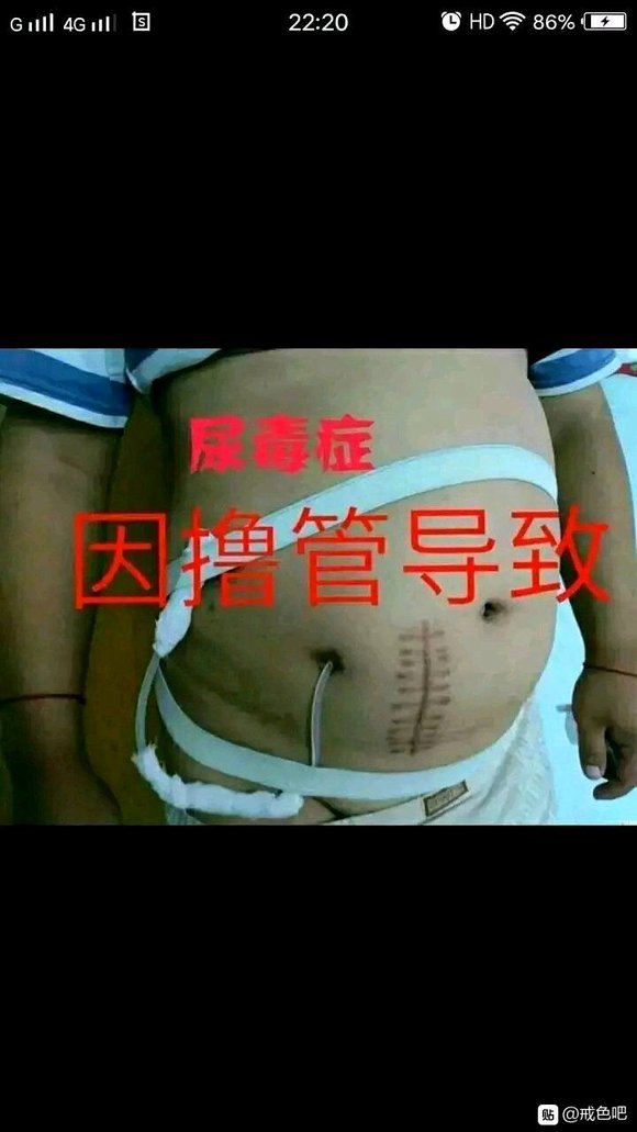 ”戒色是长跑，千万不要破戒！忍不住了也不能出去宝剑，否则就会像