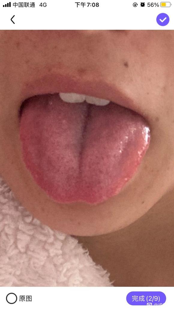 ”寒热错杂，不消化，目前打卡一个月了