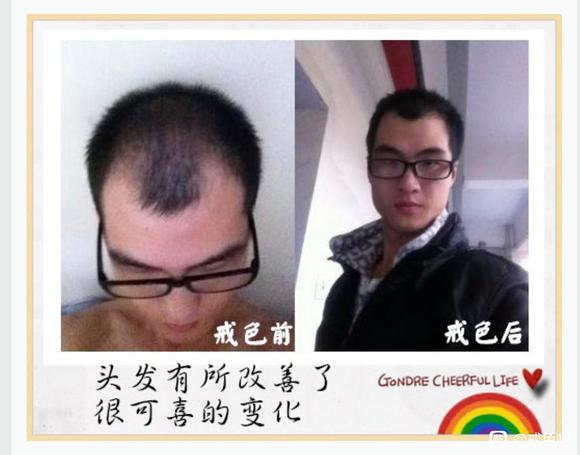 ”前辈有没有戒了之后头发恢复乌黑亮丽的案例