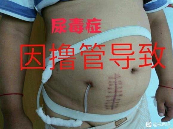 ”大脑病理性的不断思考怎么办