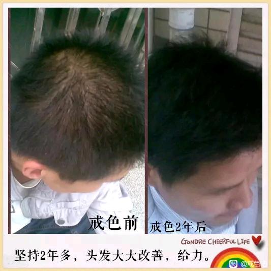 ”百位戒友戒色前后对比图（必看）