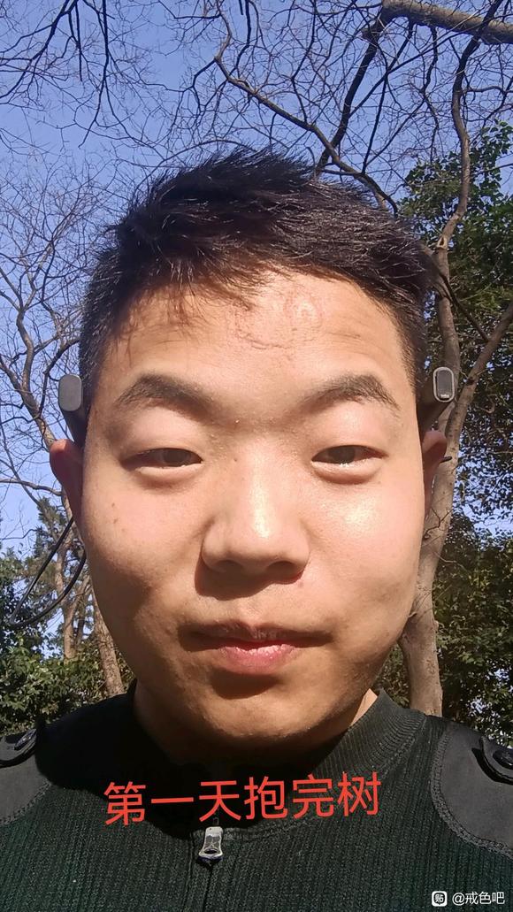 ”树疗的效果真的太好了