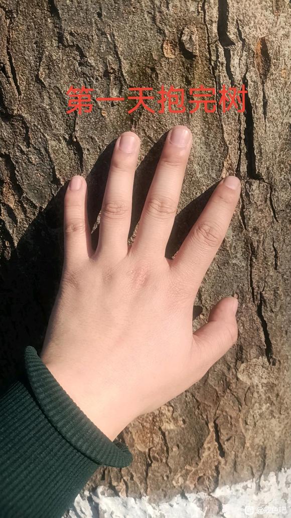 ”树疗的效果真的太好了
