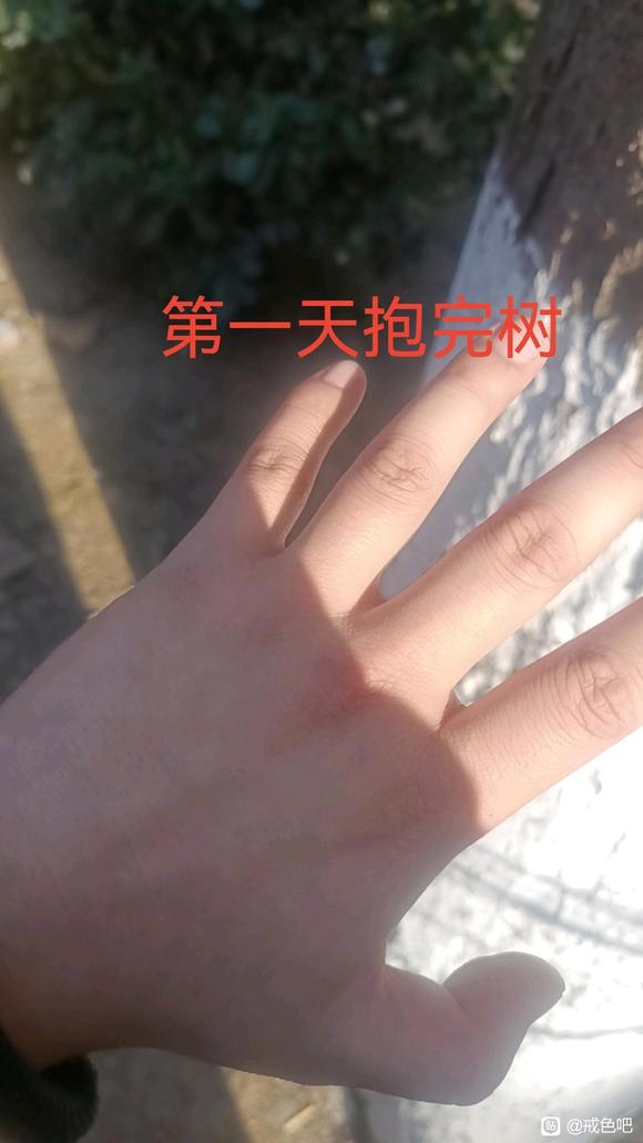 ”树疗的效果真的太好了