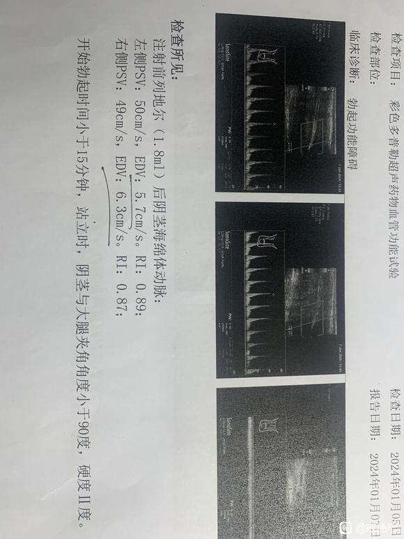 ”【静脉漏阳痿+重度早泄】这次真的见棺材了！