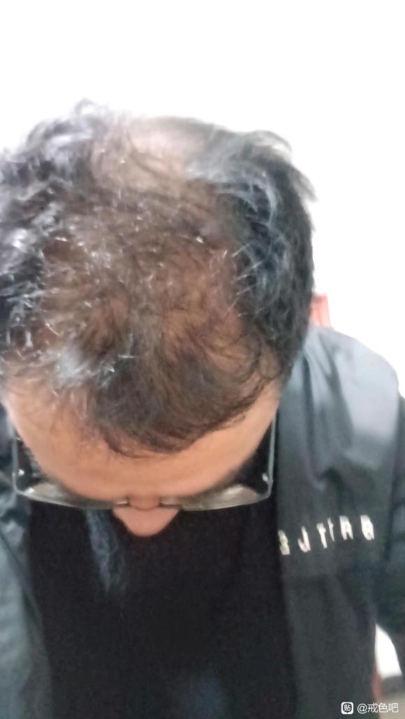 ”#微信看病卖药是假的#天天打✈，身体虚的不行咋办呀