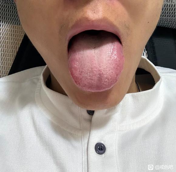 ”有没有会看舌苔的大神