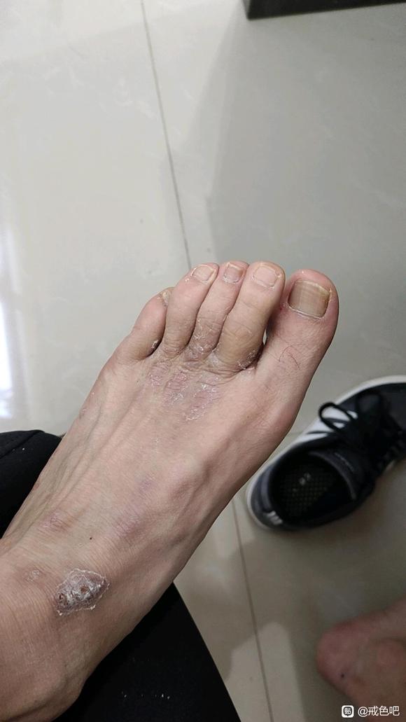 ”大家有谁遇到过这种情况