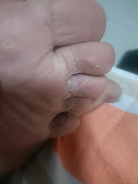 ”大家有谁遇到过这种情况