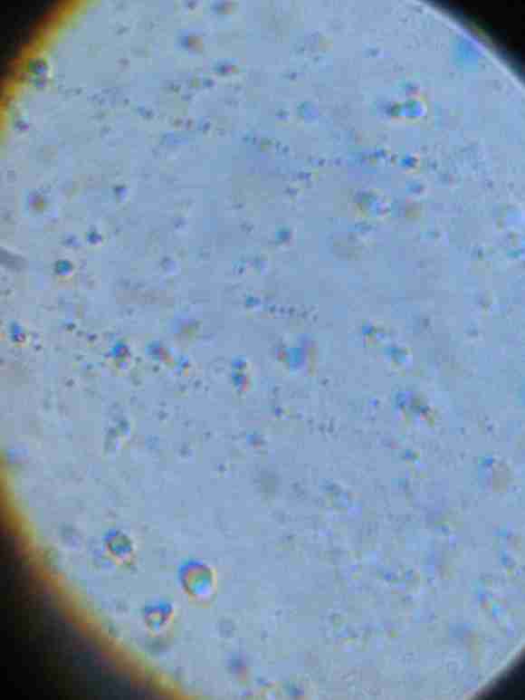 ”备孕，精子质量极差，准备戒色来提高精子质量