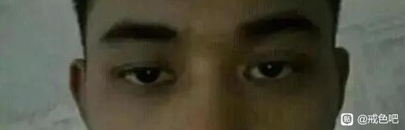 ”为什么说手yin毁容，图片对比