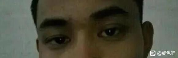 ”为什么说手yin毁容，图片对比