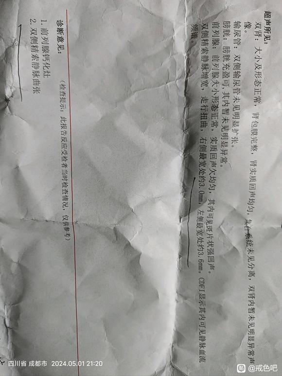 ”戒色八十天经常遗精，还有精索静脉曲张