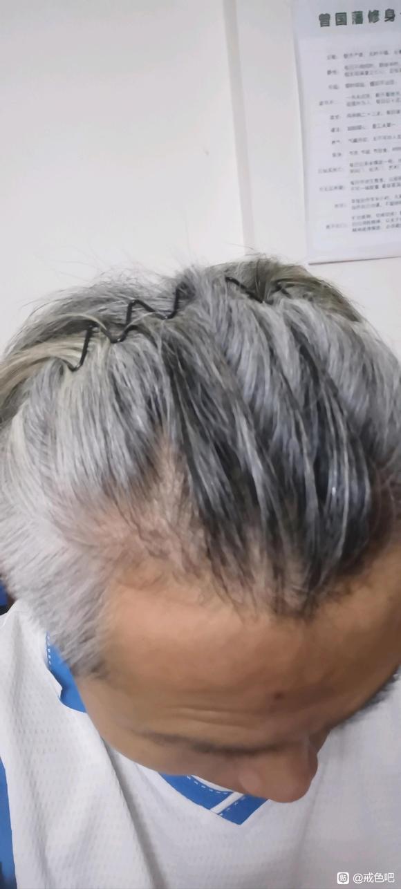 ”#微信看病卖药是假的#37岁大叔，重新开始，第19天