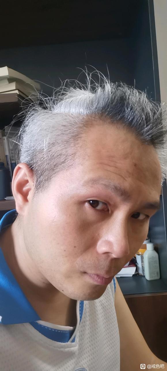 ”#微信看病卖药是假的#37岁大叔，重新开始，第19天