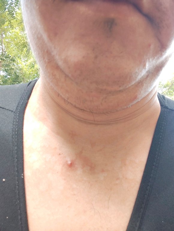 ”来戒色吧5年了，一直没有戒掉，最久戒20天就破，用了很多方法