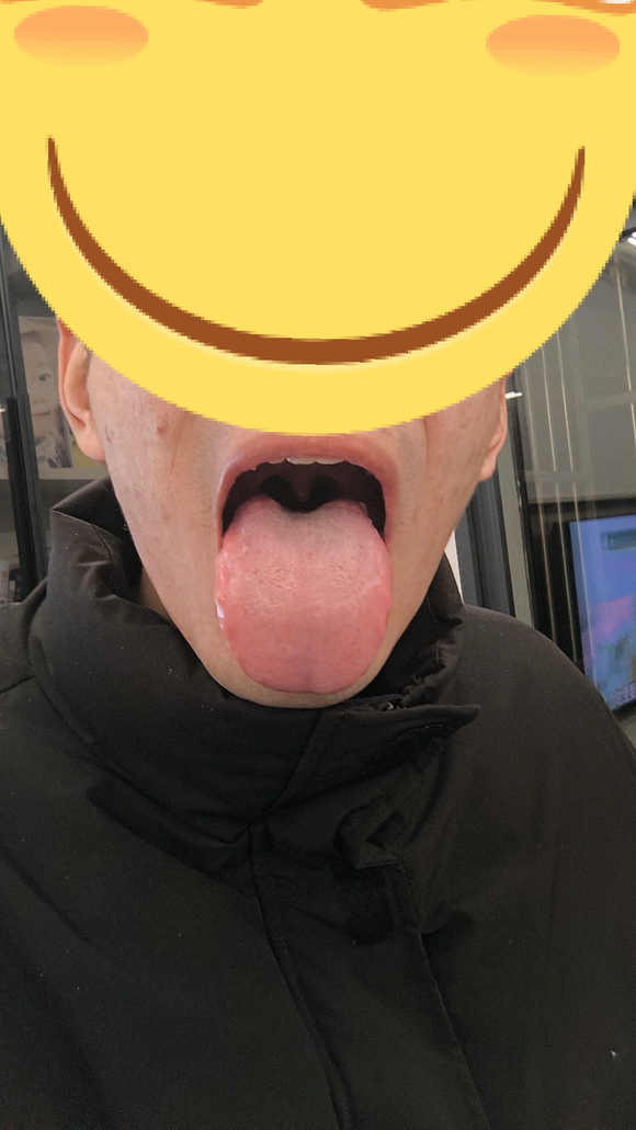 ”【发帖先看置顶】脾肾阳虚，虚劳病。求贴吧各位大佬给小弟一些建议和帮助。拜托?