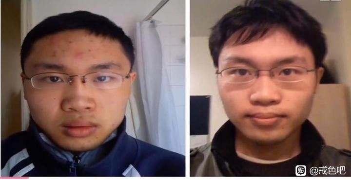 ”分享：#微信看病卖药是假的#戒色116天对比图