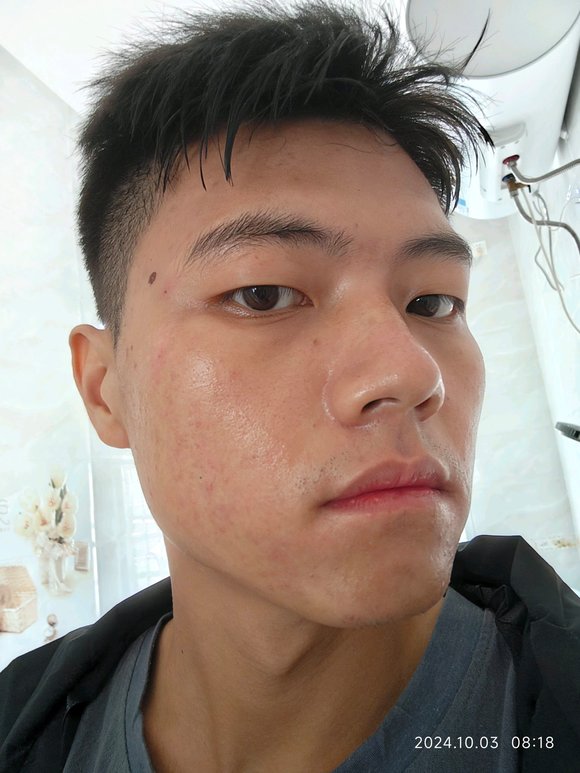 ”戒色45天后，好起来了