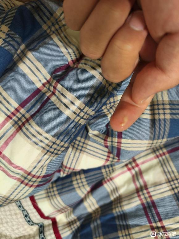 ”#微信看病卖药是假的#本人19岁，戒色40天，我的牛牛上怎么长了一个脓疱？