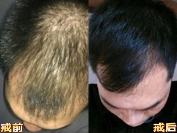 ”看看戒了差不多2个月左右