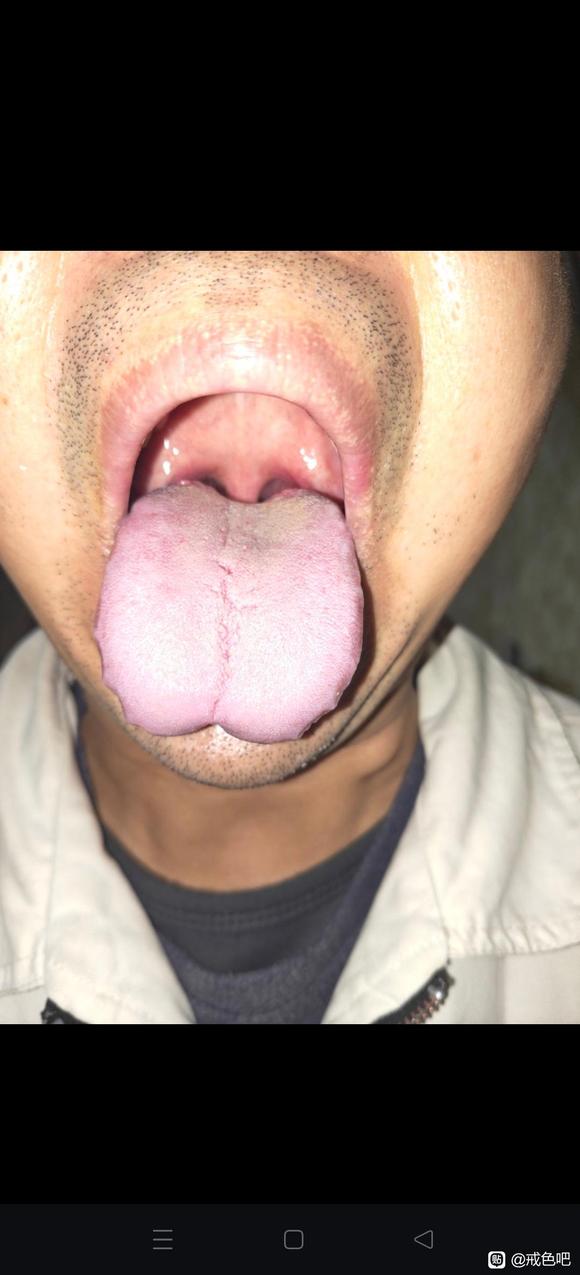 ”舌像调理三个月的变化