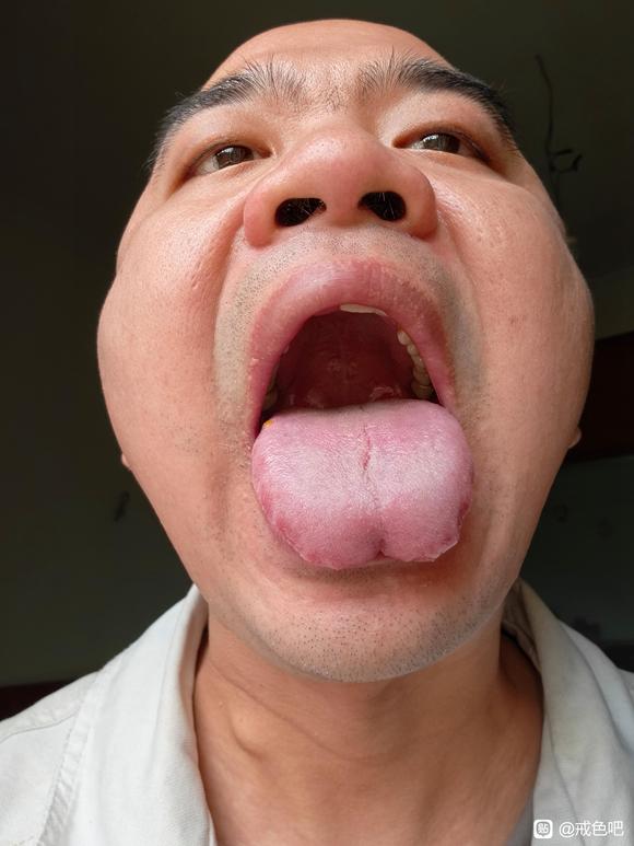 ”舌像调理三个月的变化