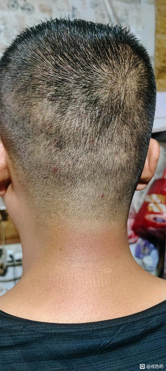 ”远离手瘾，远离黄源