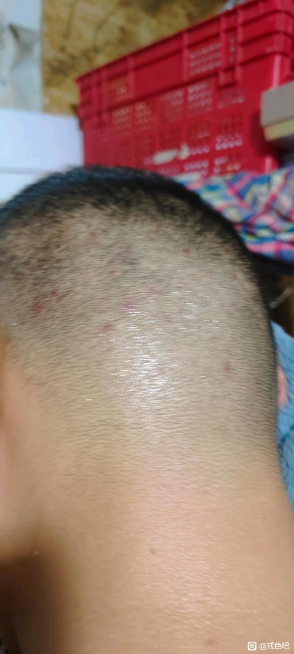 ”远离手瘾，远离黄源