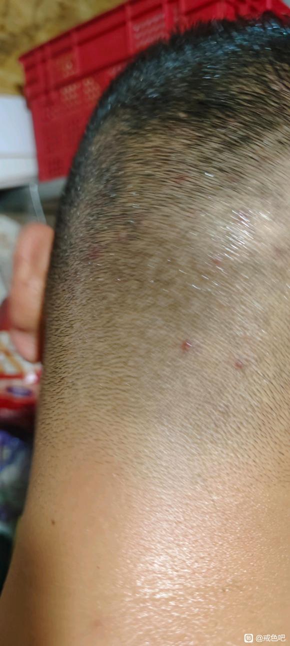 ”远离手瘾，远离黄源