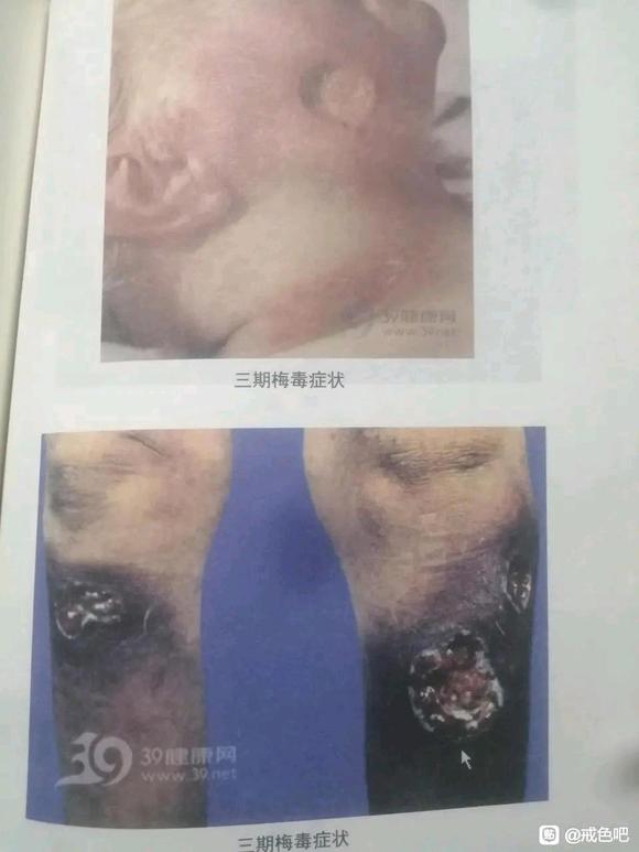 ”不知道危害多大的可以看看