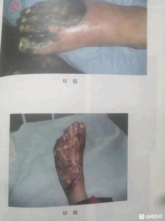 ”不知道危害多大的可以看看