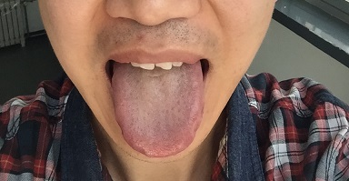 ”【邪淫危害】免费中医养生咨询