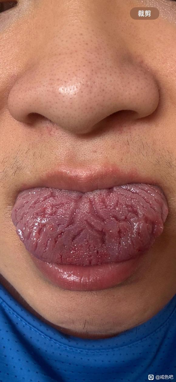 ”忍不住又来了