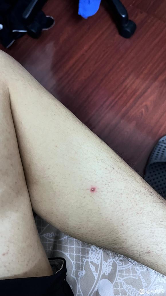 ”想让大家看看我是不是病了